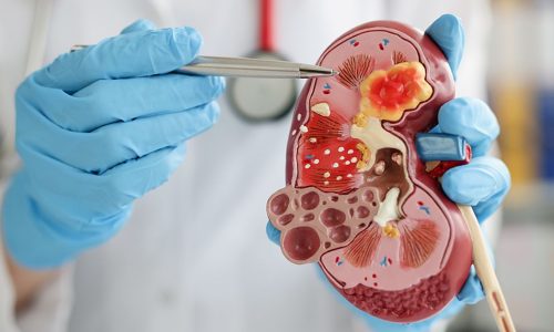 Renal Dialysis Technology